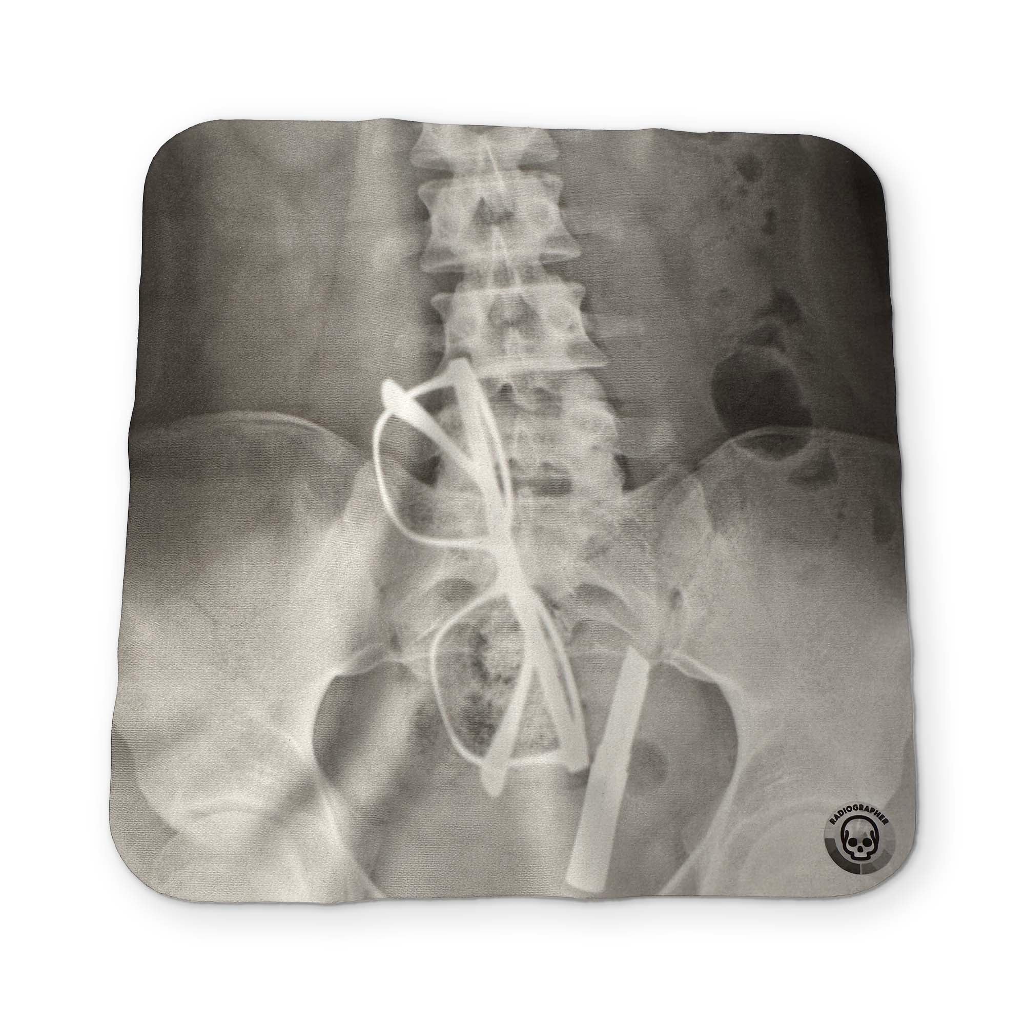 AN X-RAY YOU CAN CLEAN YOUR GLASSES WITH
