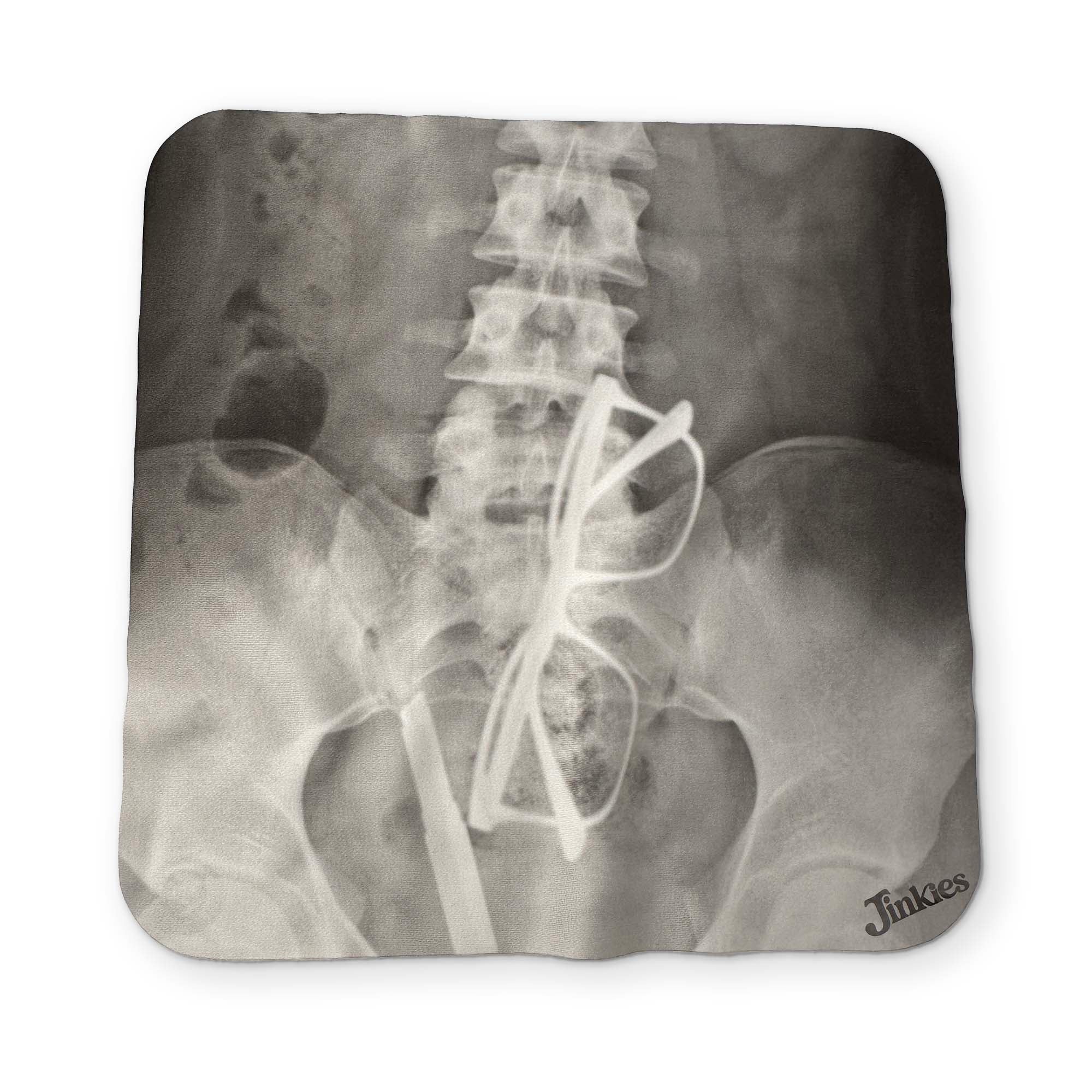 AN X-RAY YOU CAN CLEAN YOUR GLASSES WITH - Image 2